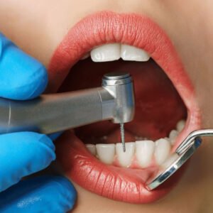 Comparison of dental implants vs dentures for periodontal disease patients in Chula Vista, CA.