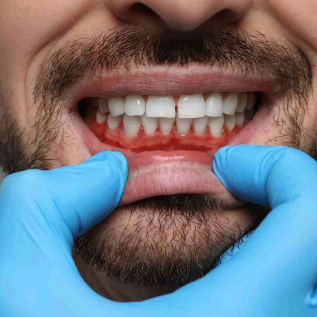 Average cost of gum disease treatment and financing in Chula Vista, CA.