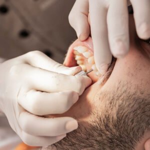 Post-operative gum surgery care and soft food diet instructions in Chula Vista, CA.