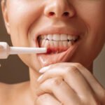 Minimally invasive gum grafting and PRF therapy for receding gums in Chula Vista, CA.