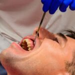 Infographic showing the causes of jawbone loss, including periodontitis and missing teeth, in Chula Vista.