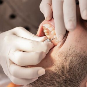 Board-certified periodontist placing dental implants in Chula Vista, CA.